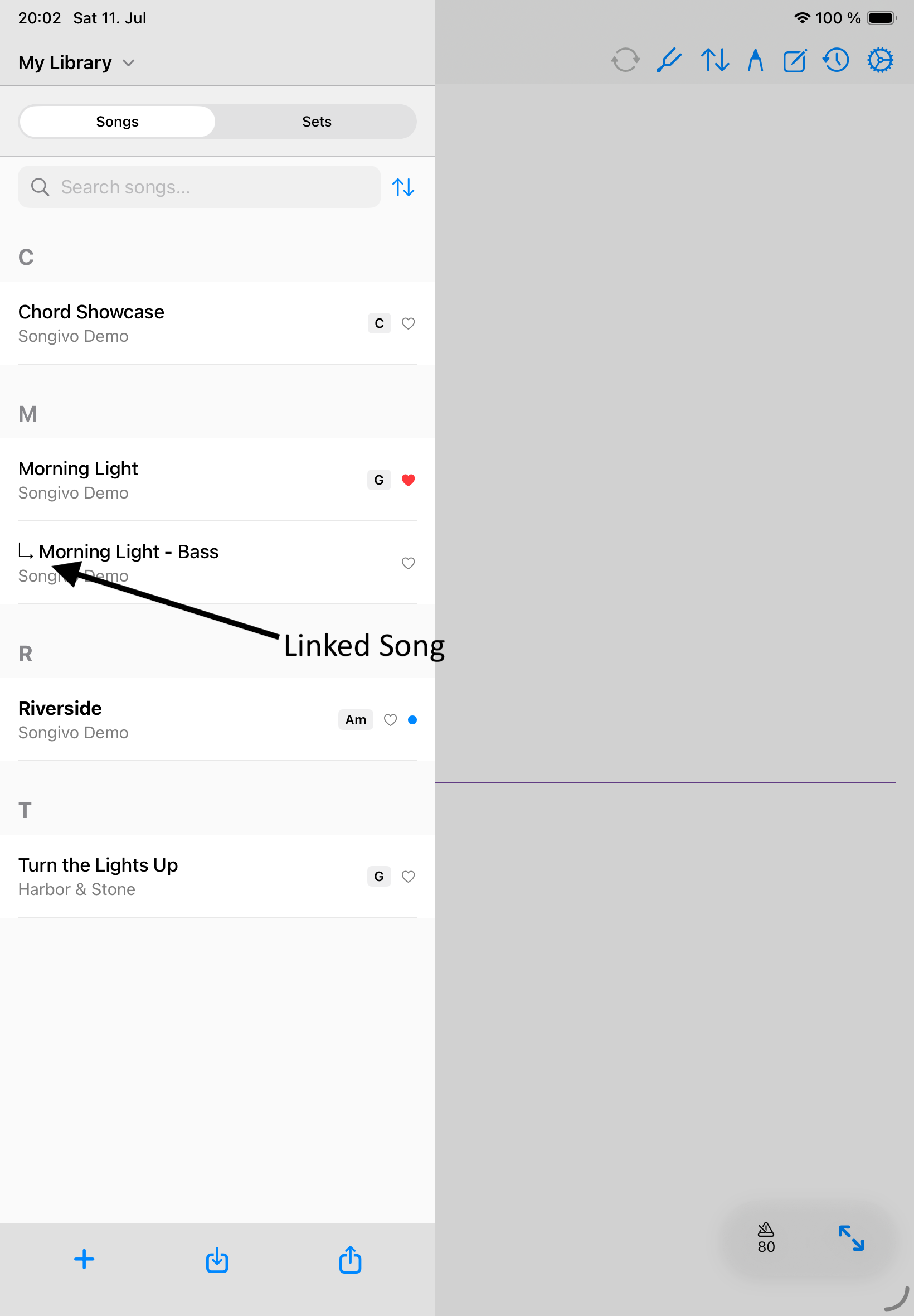 Songivo editor showing the Linked Songs manager entry for Turn the Lights Up